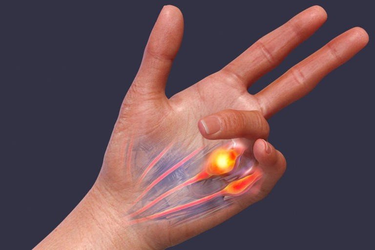 The Role of Fascia in Musculoskeletal Health: New Techniques for Fascia Care